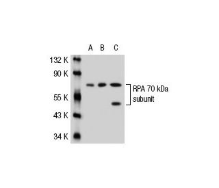 RPA 70 kDa subunit Antibody (MA70-2) - Western Blotting - Image 21186 
