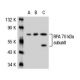 RPA 70 kDa subunit Antibody (MA70-2) - Western Blotting - Image 21186 