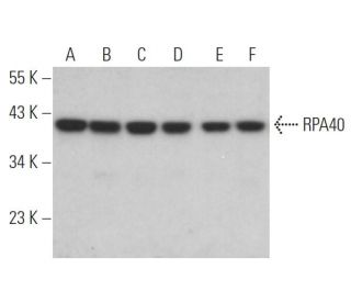 RPA40 Antibody (H-7) - Western Blotting - Image 366698 