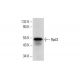 Dieser polyklonale Antikörper wird nicht mehr hergestellt. Wir empfehlen Ihnen unseren <a href="rpd3-antibody-g-9">Rpd3 (G-9)</a> monoklonalen Antikörper (Beispielsdaten werden angezeigt). western blotting image from recommended Rpd3 (G-9) monoclonal antibody replacement. Image 317954