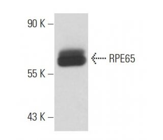RPE65 Antibody (3D9) - Western Blotting - Image 18139