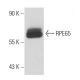 RPE65 Antibody (3D9) - Western Blotting - Image 18139