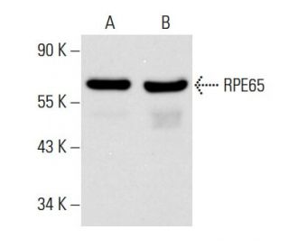 RPE65 Antibody (8B11) - Western Blotting - Image 14612