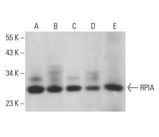 RPIA Antibody (D-5) - Western Blotting - Image 376989 