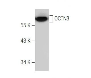RPMI2650 Whole Cell Lysate: sc-364192. Western blot analysis of SLC22A9...