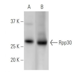 Rpp30 Antibody (2931D5a) - Western Blotting - Image 399554 
