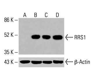RRS1 Antibody (H-5) - Western Blotting - Image 416012