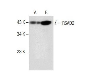 RSAD2 Antibody (G-8) - Western Blotting - Image 287851Each CRISPR/Cas9 Knockout (KO) Plasmid product consists of a pool of 3 plasmids designed to ensure identification and cleavage of a specific gene for maximum knockout efficiency. Each plasmid encodes a unique 20 nt sequence derived from the GeCKO (v2) library.
