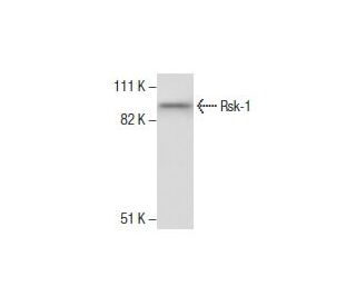 Rsk-1 Antibody (10B1D7) - Western Blotting - Image 285888 