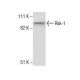 Rsk-1 Antibody (10B1D7) - Western Blotting - Image 285888 