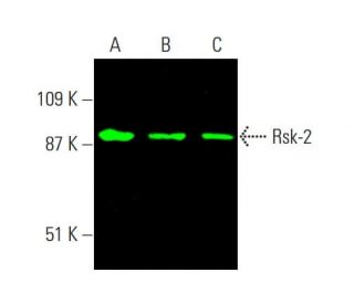 western blotting image from recommended Rsk-2 (E-1) monoclonal antibody replacement. Image 381555