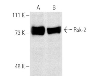 Rsk-2 Antibody (E-1) - Western Blotting - Image 1890