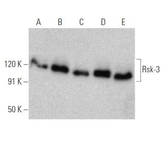 western blotting image from recommended Rsk-3 (3C4C8) monoclonal antibody replacement. Image 372274