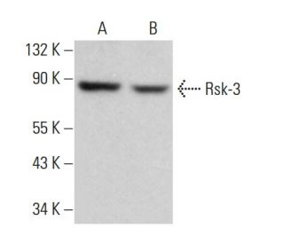 Rsk-3 Antibody (3C4C8) - Western Blotting - Image 380363Each CRISPR/Cas9 Knockout (KO) Plasmid product consists of a pool of 3 plasmids designed to ensure identification and cleavage of a specific gene for maximum knockout efficiency. Each plasmid encodes a unique 20 nt sequence derived from the GeCKO (v2) library.