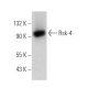 western blotting image from recommended Rsk-4 (JS-31) monoclonal antibody replacement. Image 368205