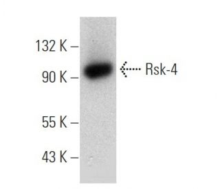 Rsk-4 Antibody (JS-31) - Western Blotting - Image 368205 