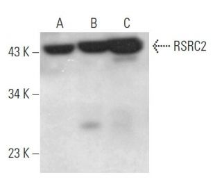 RSRC2 Antibody (D-3) - Western Blotting - Image 371733 