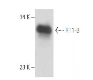 RT1-B Antibody (HIS 19) - Western Blotting - Image 17188