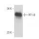 RT1-B Antibody (HIS 19) - Western Blotting - Image 17188
