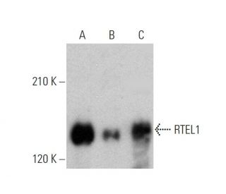 RTEL1 Antibody (H-5) - Western Blotting - Image 359595 