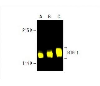 RTEL1 Antibody (H-5) - Western Blotting - Image 392788Each CRISPR/Cas9 Knockout (KO) Plasmid product consists of a pool of 3 plasmids designed to ensure identification and cleavage of a specific gene for maximum knockout efficiency. Each plasmid encodes a unique 20 nt sequence derived from the GeCKO (v2) library.