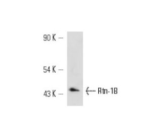 Rtn-1A/B Antibody (RNL-3) - Western Blotting - Image 12700