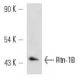 Rtn-1A/B Antibody (RNL-3) - Western Blotting - Image 12700