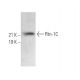 Rtn-1C Antibody (4A71) - Western Blotting - Image 371508