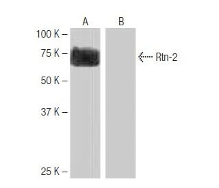 Rtn-2 Antibody (PL-A9) - Western Blotting - Image 65047