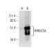 RUNDC3A Antibody (E-2) - Western Blotting - Image 281682