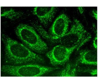 RUNDC3A Antibody (H-9) - Immunofluorescence - Image 296347 