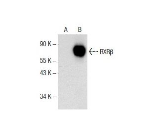 RXRβ<sub>1 Antibody (</sub>A-1) - Western Blotting - Image 153157Each CRISPR/Cas9 Knockout (KO) Plasmid product consists of a pool of 3 plasmids designed to ensure identification and cleavage of a specific gene for maximum knockout efficiency. Each plasmid encodes a unique 20 nt sequence derived from the GeCKO (v2) library.