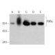 western blotting image from recommended RXRα (H-10) monoclonal antibody replacement. Image 381017