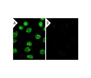 RXR&alpha; siRNA (h): sc-36447. Immunofluorescence staining of methanol-fixed, control HeLa (A) and RXR&alpha; siRNA silen 