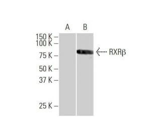 RXR&beta; Antibody (3C8) - Western Blotting - Image 352141 
