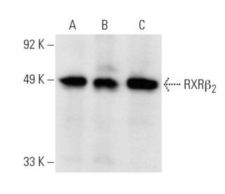 RXR&beta; Antibody (MOK13-17) - Western Blotting - Image 14622