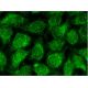 immunofluorescence image from recommended RXRγ (A-2) monoclonal antibody replacement. Image 145102