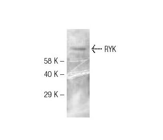 RYK Antibody (F35 P7 D7 F5) - Western Blotting - Image 131997