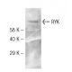 RYK Antibody (F35 P7 D7 F5) - Western Blotting - Image 131997