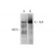western blotting image from recommended RyR (F-1) monoclonal antibody replacement. Image 305782