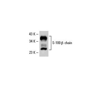 S-100 &alpha;/&beta; chain Antibody (4B3) - Western Blotting - Image 19550 