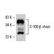 S-100 α/β chain Antibody (4B3) - Western Blotting - Image 19550 