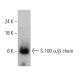 S-100 α/β chain Antibody (4B3) - Western Blotting - Image 384045