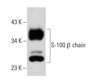 S-100 &alpha;/&beta; chain Antibody (6G1) - Western Blotting - Image 19551