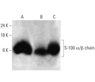 S-100 &alpha;/&beta; chain Antibody (B32.1) - Western Blotting - Image 384044