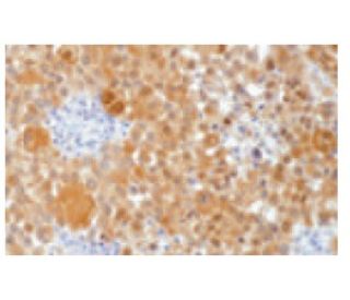 S-100 &alpha; chain Antibody (4c4.9) - Immunohistochemistry - Image 67408