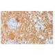 S-100 α chain Antibody (4c4.9) - Immunohistochemistry - Image 67408