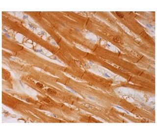 S-100 Antibody (S1-61) - Immunohistochemistry - Image 293643 