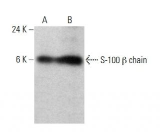S-100 &beta; chain Antibody (19) - Western Blotting - Image 386126 