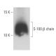 S-100 β chain Antibody (19) - Western Blotting - Image 400005
